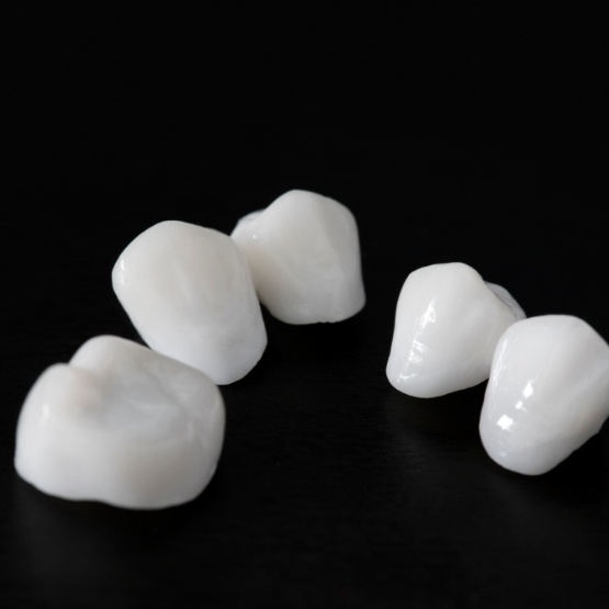 Metal free restorations on a black surface