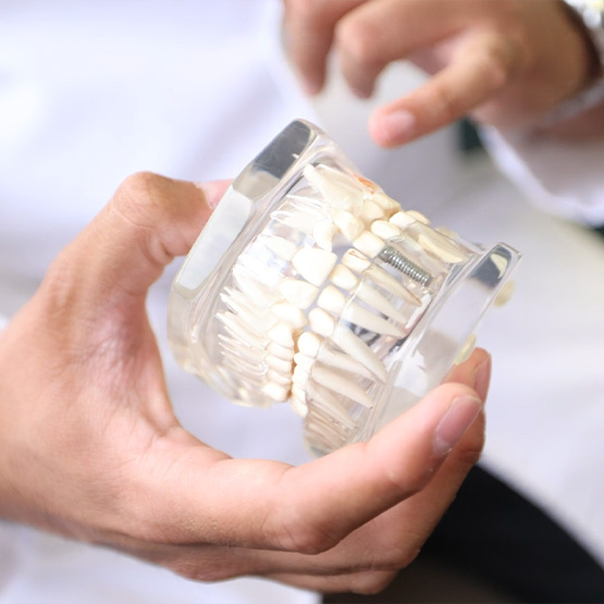 Dental implant bridge in a plastic tray