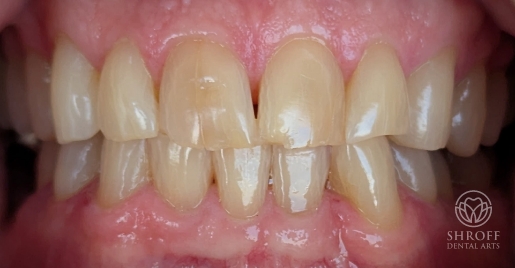 Smile before dental treatment 