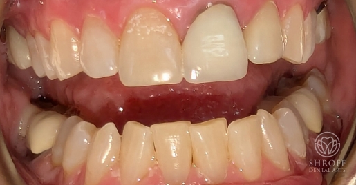 Smile before dental treatment 