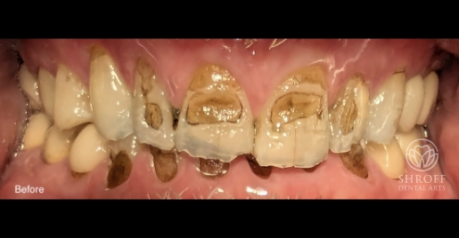 Smile before dental treatment 