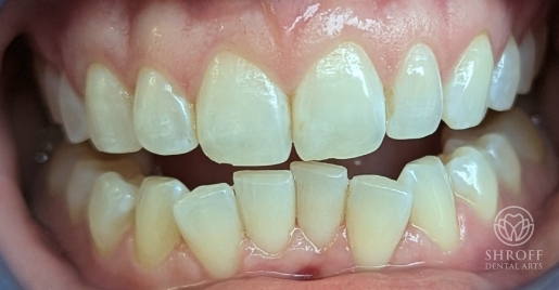 Smile before dental treatment 