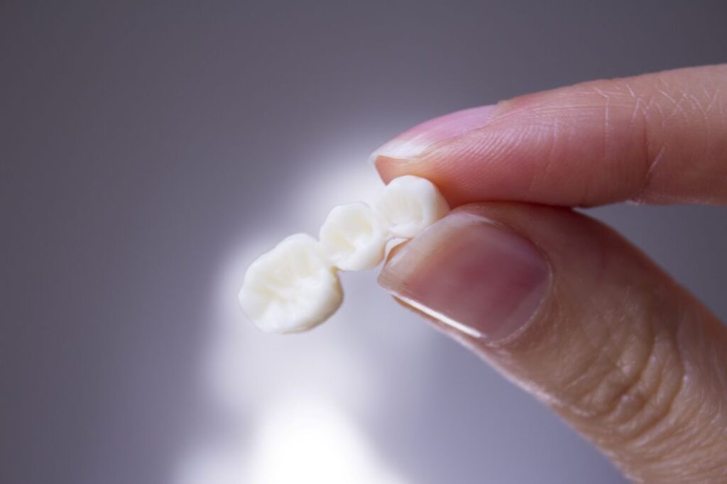 A hand holding a dental bridge